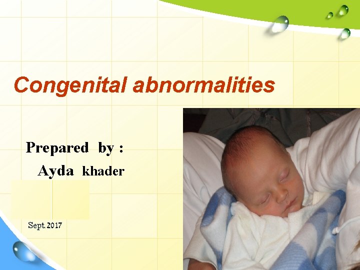 Congenital abnormalities Prepared by : Ayda khader Sept. 2017 