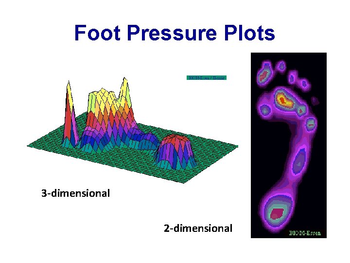 Foot Pressure Plots 3 -dimensional 2 -dimensional 