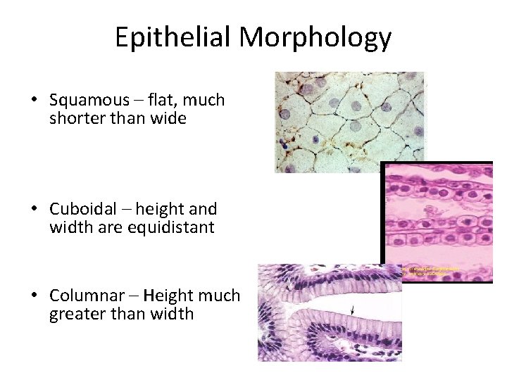 Epithelial Morphology • Squamous – flat, much shorter than wide • Cuboidal – height