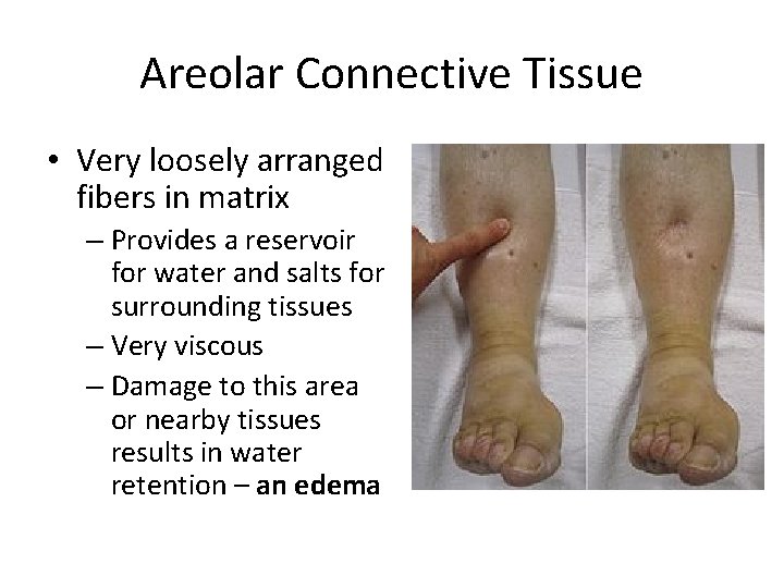 Areolar Connective Tissue • Very loosely arranged fibers in matrix – Provides a reservoir