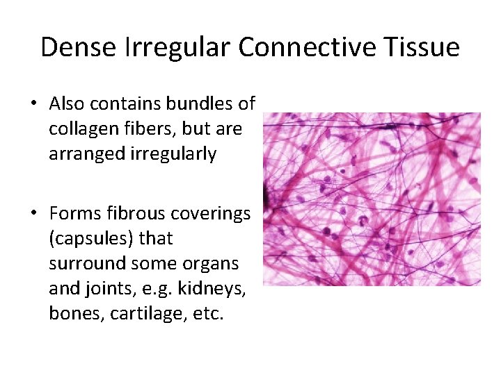 Dense Irregular Connective Tissue • Also contains bundles of collagen fibers, but are arranged