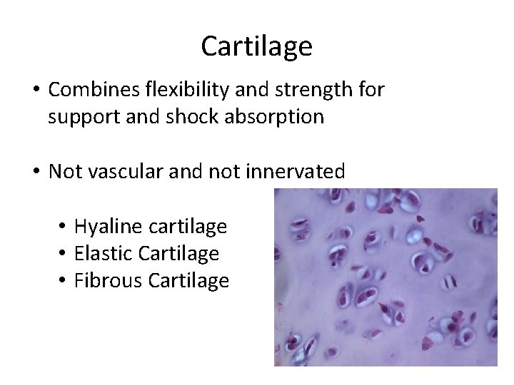 Cartilage • Combines flexibility and strength for support and shock absorption • Not vascular