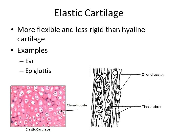 Elastic Cartilage • More flexible and less rigid than hyaline cartilage • Examples –