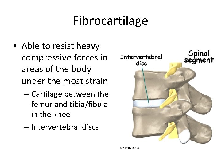 Fibrocartilage • Able to resist heavy compressive forces in areas of the body under
