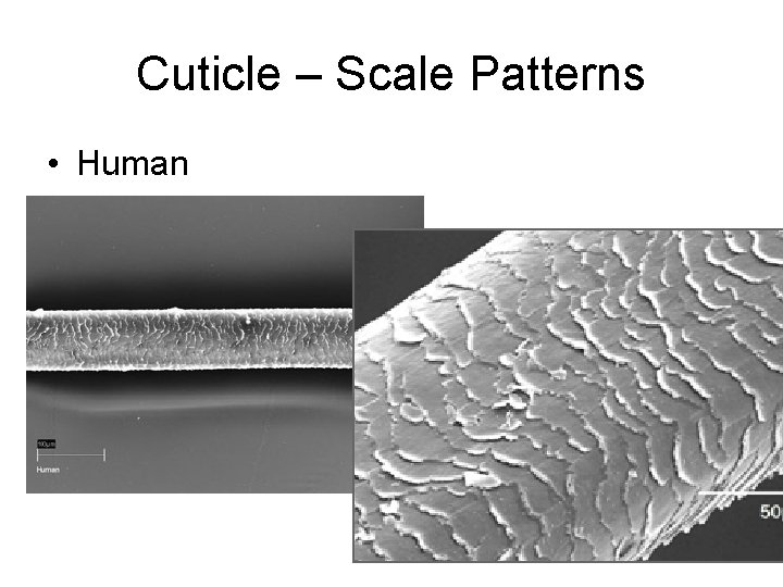 Cuticle – Scale Patterns • Human 