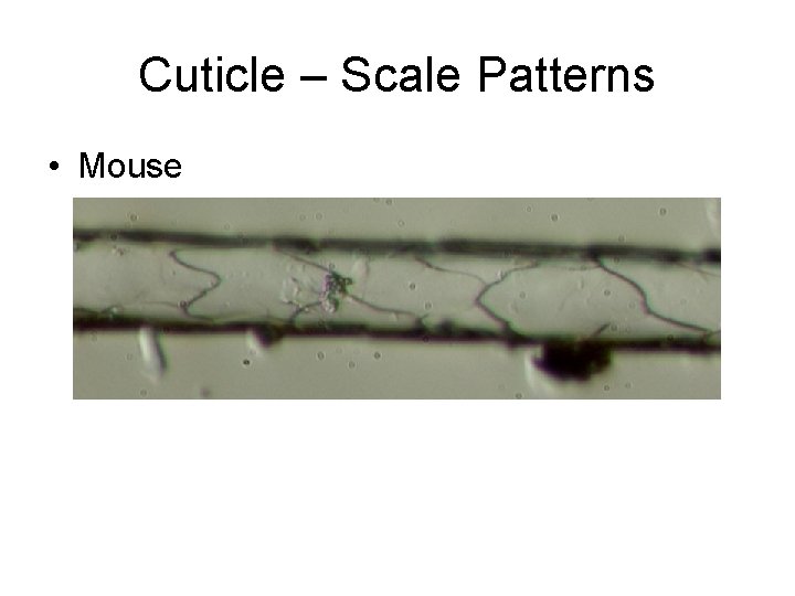 Cuticle – Scale Patterns • Mouse 