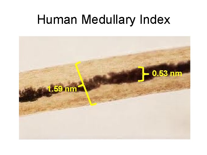 Human Medullary Index 0. 53 nm 1. 59 nm 