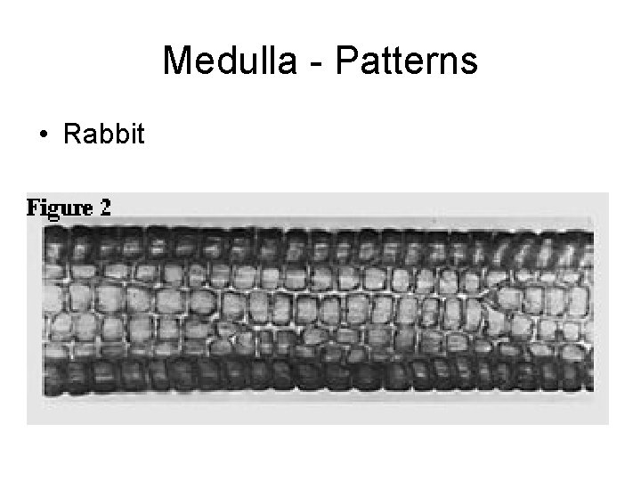 Medulla - Patterns • Rabbit 