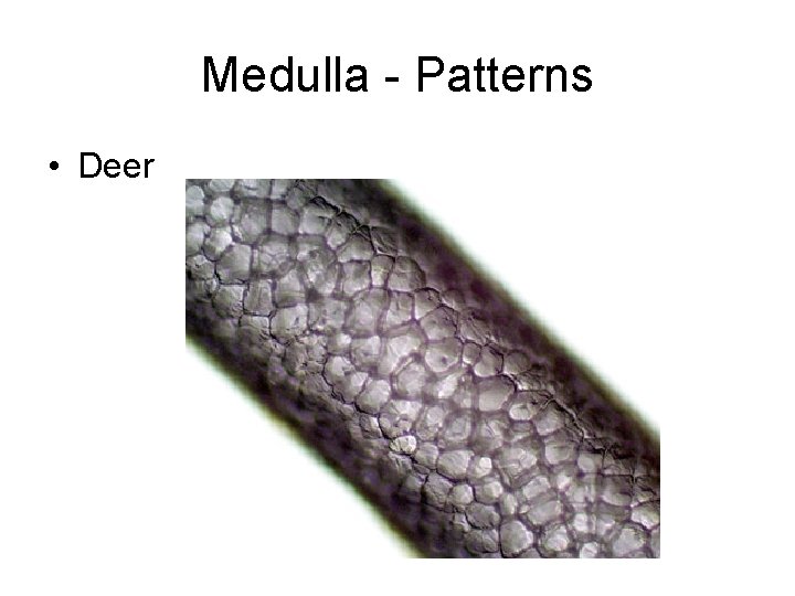 Medulla - Patterns • Deer 