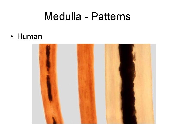 Medulla - Patterns • Human 