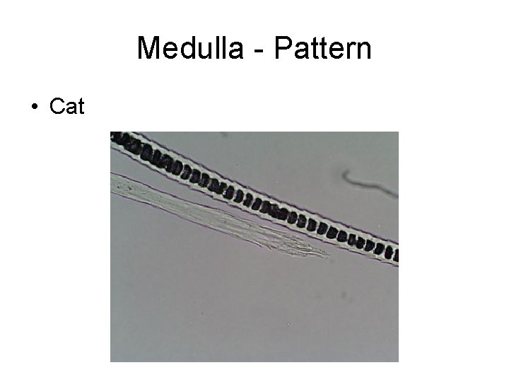 Medulla - Pattern • Cat 