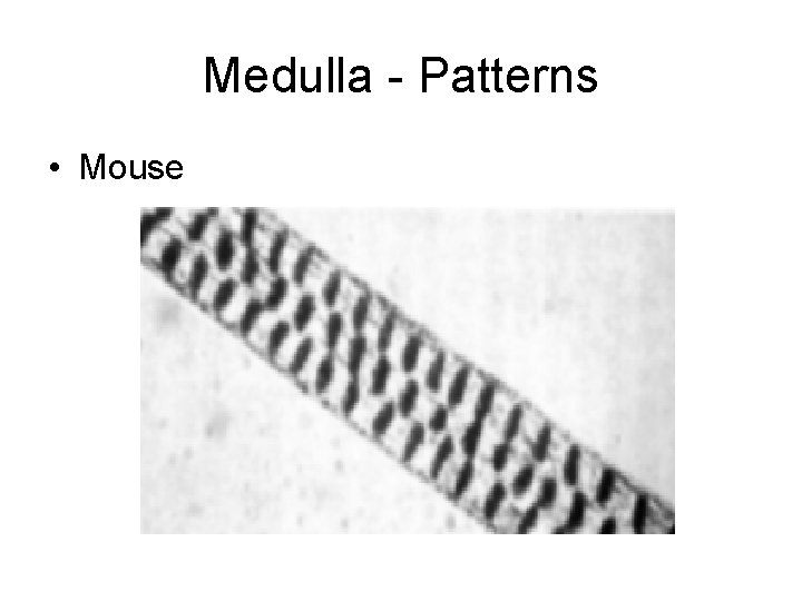 Medulla - Patterns • Mouse 