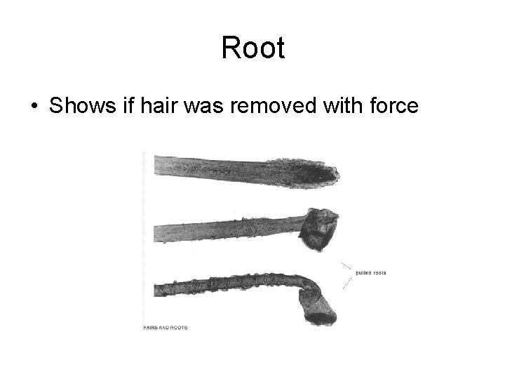 Root • Shows if hair was removed with force 