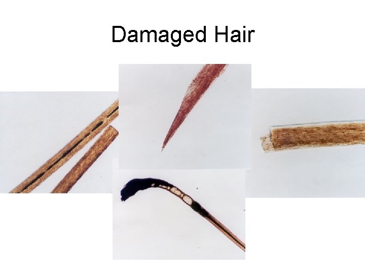 Damaged Hair 
