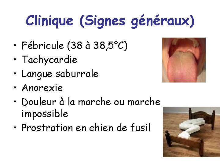 Clinique (Signes généraux) • • • Fébricule (38 à 38, 5°C) Tachycardie Langue saburrale