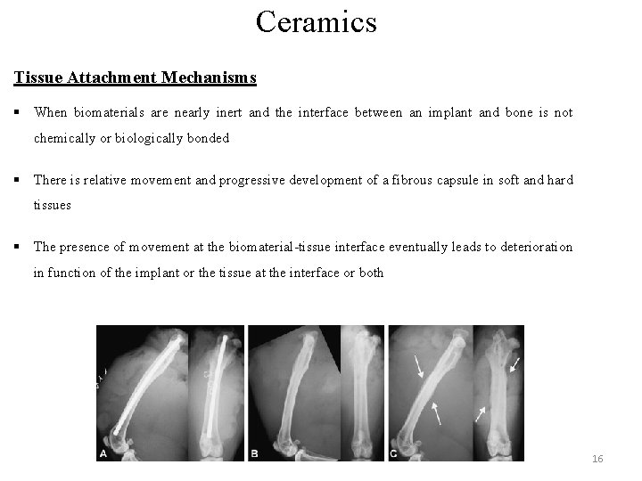 Ceramics Tissue Attachment Mechanisms § When biomaterials are nearly inert and the interface between Ceramics Tissue Attachment Mechanisms § When biomaterials are nearly inert and the interface between