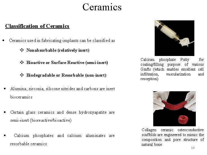 Ceramics Classification of Ceramics § Ceramics used in fabricating implants can be classified as Ceramics Classification of Ceramics § Ceramics used in fabricating implants can be classified as