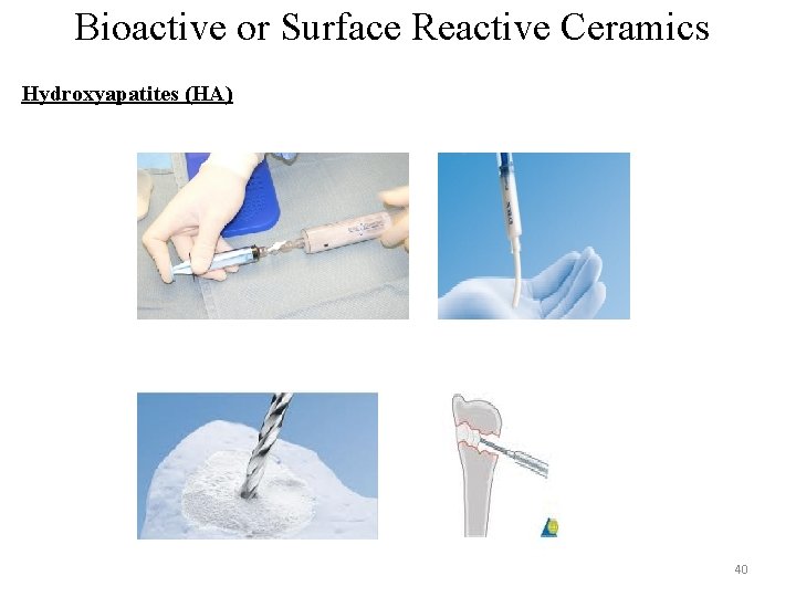 Bioactive or Surface Reactive Ceramics Hydroxyapatites (HA) 40 Bioactive or Surface Reactive Ceramics Hydroxyapatites (HA) 40