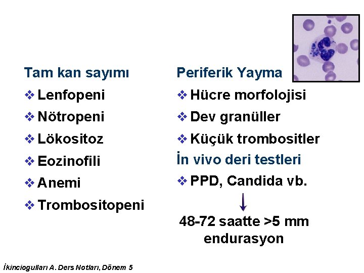 Tam kan sayımı Periferik Yayma v Lenfopeni v Hücre morfolojisi v Nötropeni v Dev Tam kan sayımı Periferik Yayma v Lenfopeni v Hücre morfolojisi v Nötropeni v Dev