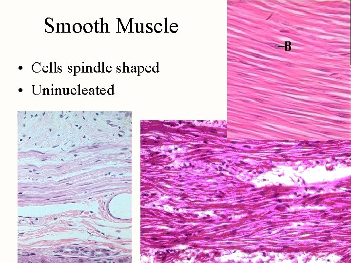 Smooth Muscle • Cells spindle shaped • Uninucleated 