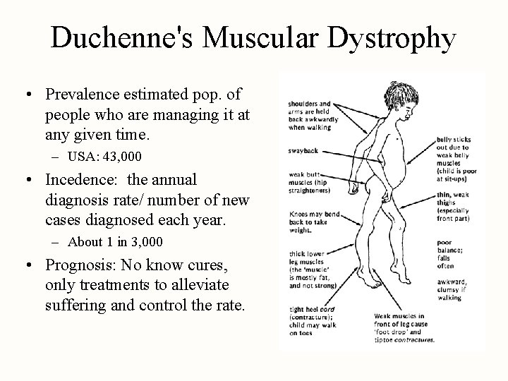 Duchenne's Muscular Dystrophy • Prevalence estimated pop. of people who are managing it at