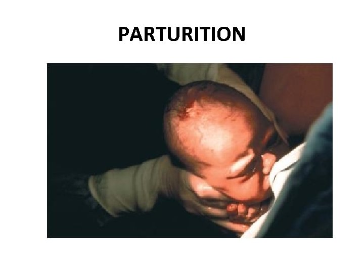 PARTURITION 