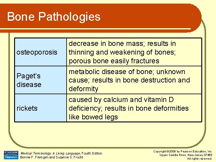 Bone Pathologies osteoporosis decrease in bone mass; results in thinning and weakening of bones;