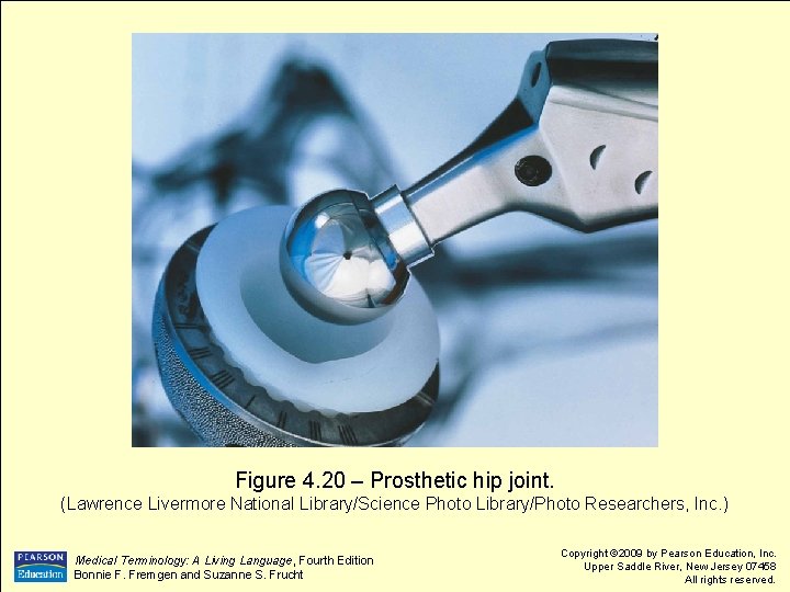 Figure 4. 20 – Prosthetic hip joint. (Lawrence Livermore National Library/Science Photo Library/Photo Researchers,