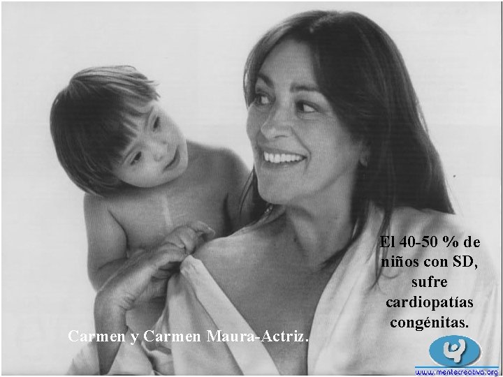 Carmen y Carmen Maura-Actriz. El 40 -50 % de niños con SD, sufre cardiopatías