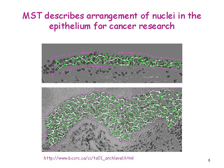 MST describes arrangement of nuclei in the epithelium for cancer research http: //www. bccrc.