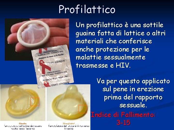 Profilattico Un profilattico è una sottile guaina fatta di lattice o altri materiali che