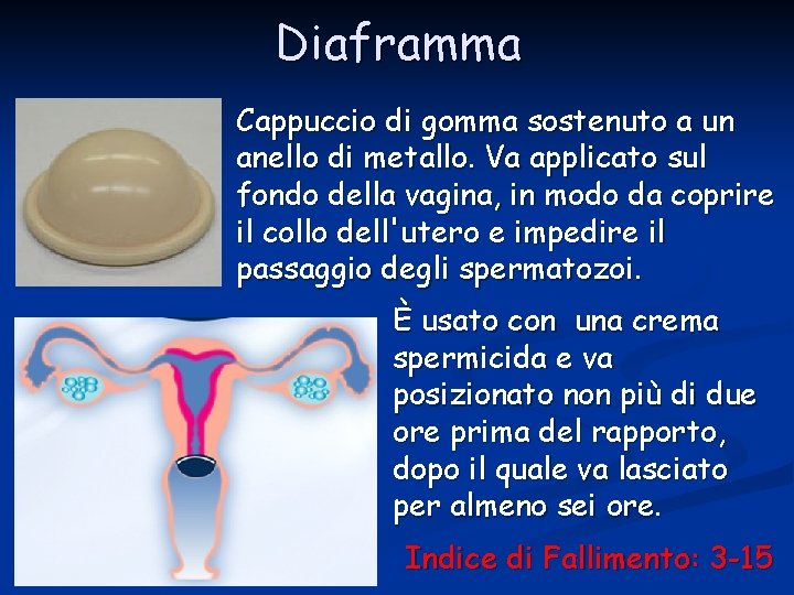 Diaframma Cappuccio di gomma sostenuto a un anello di metallo. Va applicato sul fondo