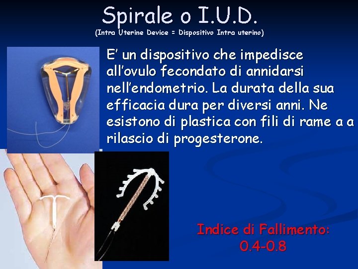 Spirale o I. U. D. (Intra Uterine Device = Dispositivo Intra uterino) E’ un