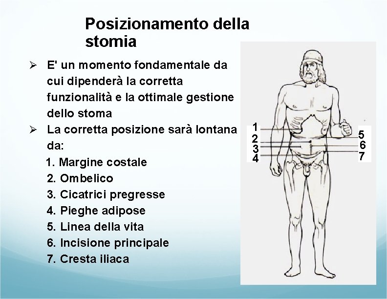 Posizionamento della stomia Ø E' un momento fondamentale da cui dipenderà la corretta funzionalità Posizionamento della stomia Ø E' un momento fondamentale da cui dipenderà la corretta funzionalità