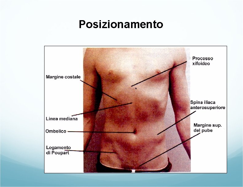 Posizionamento Posizionamento