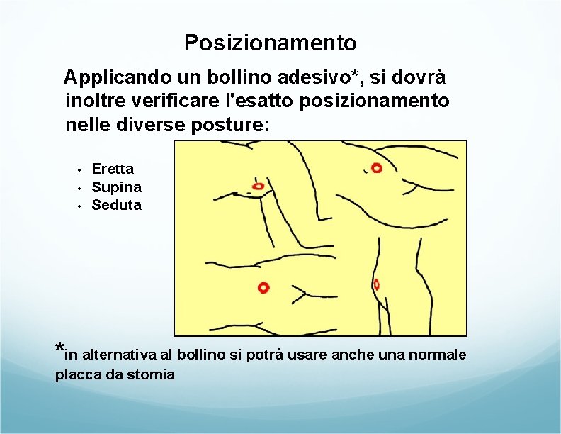 Posizionamento Applicando un bollino adesivo*, si dovrà inoltre verificare l'esatto posizionamento nelle diverse posture: Posizionamento Applicando un bollino adesivo*, si dovrà inoltre verificare l'esatto posizionamento nelle diverse posture: