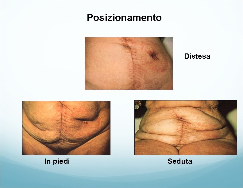 Posizionamento Distesa In piedi Seduta Posizionamento Distesa In piedi Seduta