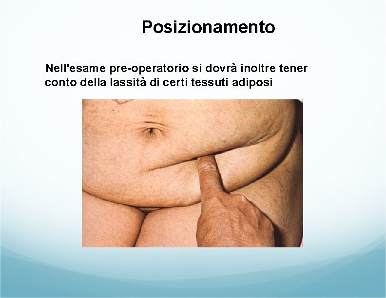 Posizionamento Nell'esame pre-operatorio si dovrà inoltre tener conto della lassità di certi tessuti adiposi Posizionamento Nell'esame pre-operatorio si dovrà inoltre tener conto della lassità di certi tessuti adiposi