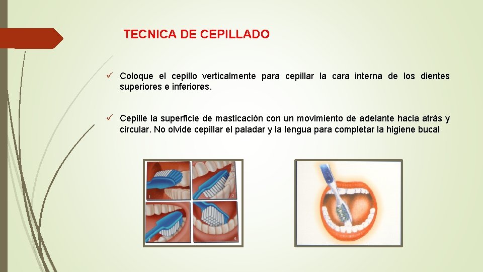 TECNICA DE CEPILLADO ü Coloque el cepillo verticalmente para cepillar la cara interna de