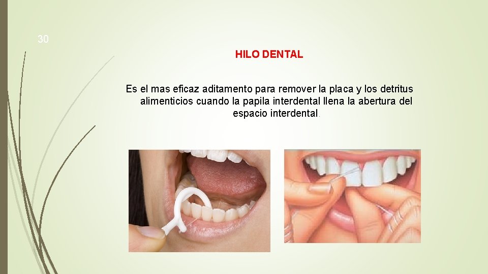 30 HILO DENTAL Es el mas eficaz aditamento para remover la placa y los