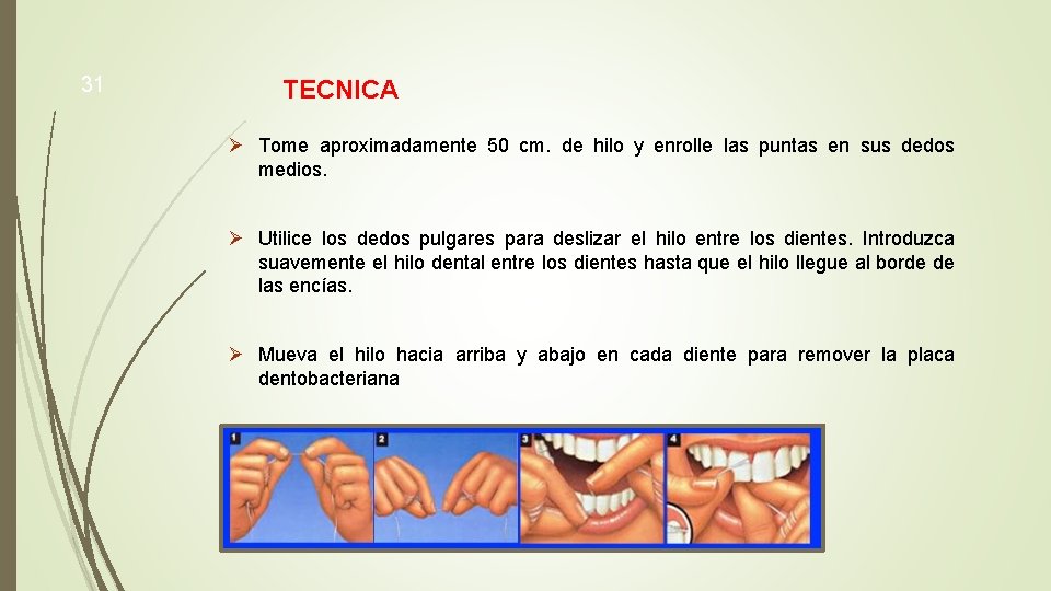 31 TECNICA Ø Tome aproximadamente 50 cm. de hilo y enrolle las puntas en