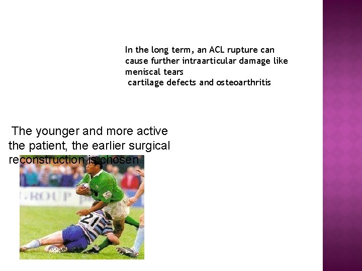 In the long term, an ACL rupture can cause further intraarticular damage like meniscal