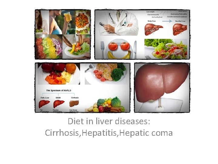 Diet in liver diseases: Cirrhosis, Hepatitis, Hepatic coma 