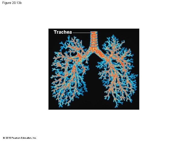 Figure 20. 13 b Trachea © 2015 Pearson Education, Inc. Figure 20. 13 b Trachea © 2015 Pearson Education, Inc.