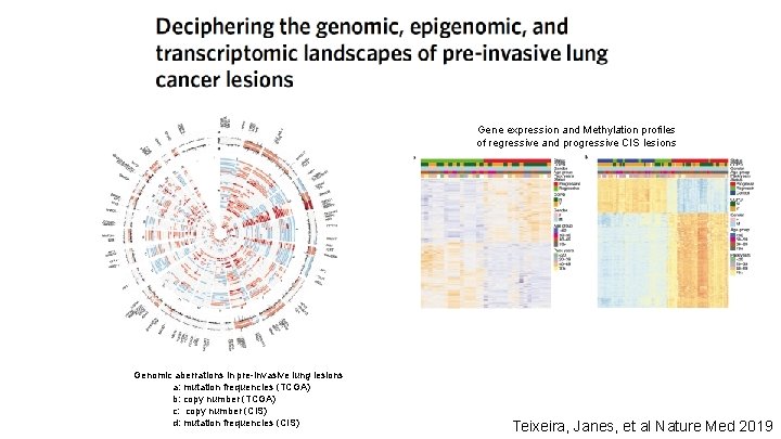 Gene expression and Methylation profiles of regressive and progressive CIS lesions Genomic aberrations in