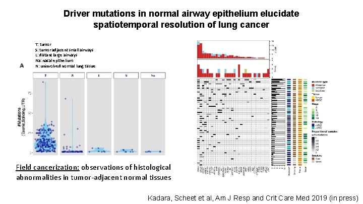 Driver mutations in normal airway epithelium elucidate spatiotemporal resolution of lung cancer T: tumor