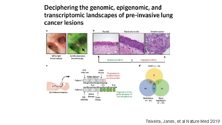 Teixeira, Janes, et al Nature Med 2019 