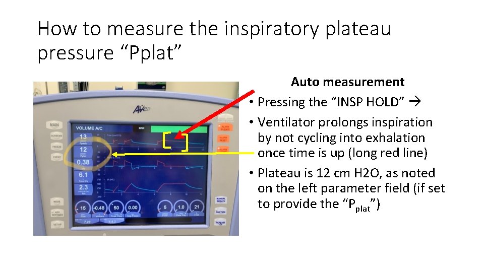 How to measure the inspiratory plateau pressure “Pplat” Auto measurement • Pressing the “INSP