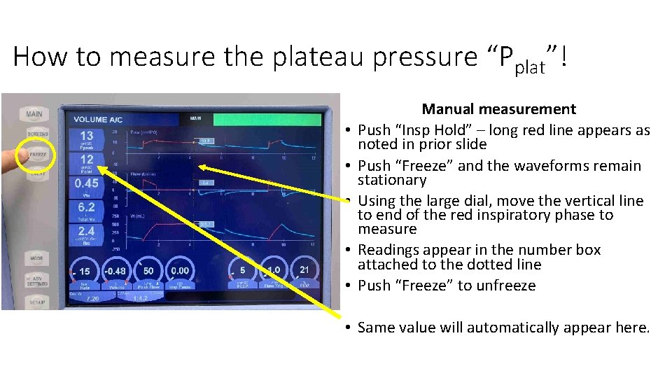 How to measure the plateau pressure “Pplat”! • • • Manual measurement Push “Insp