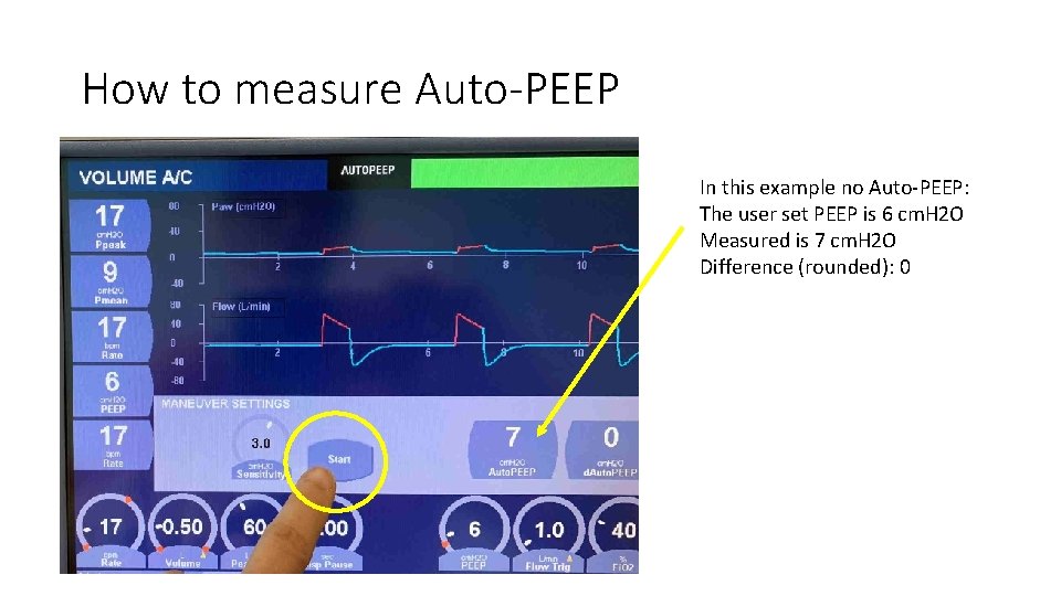 How to measure Auto-PEEP In this example no Auto-PEEP: The user set PEEP is